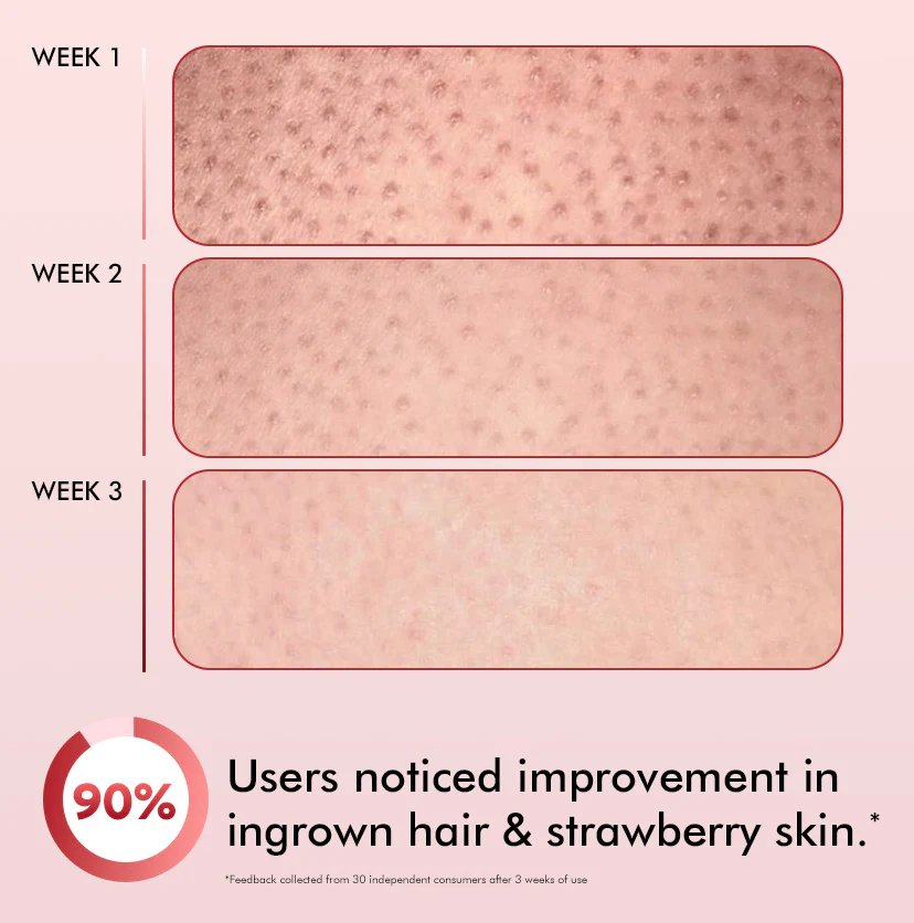 11% AHA BHA Strawberry Body Lotion for Skin Smoothening - Image 8